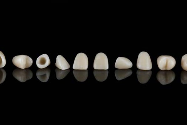 Dental Crown Uses In Same Day Dentistry