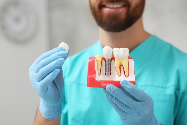 Bone And Gum Grafting Before Dental Implant Placement