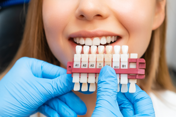 Can Dental Veneers Cover Imperfections On Teeth?