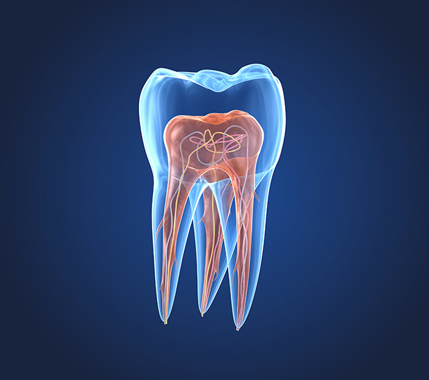 San Lorenzo What is an Endodontist